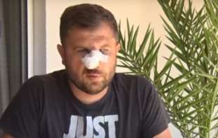 TEŠKO PRETUČEN SRBIN! ĐOŠIĆ: Komšija Albanac me napao u prisustvu deteta! Nema nama ovde zaštite!
