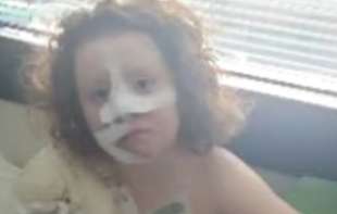 Danijela (8) dobila duksericu sa Temua, a onda se zapalila u njoj! Topila se poput plastike, koža se ljuštila sa nje (VIDEO)