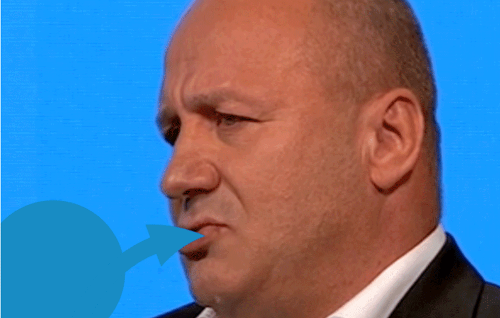 Dragiša Simić u emisiji uživo sa modricom od Ljupkinog NOKAUTA:  Nemojte se sukobljavati sa ženama! Iskulirajte