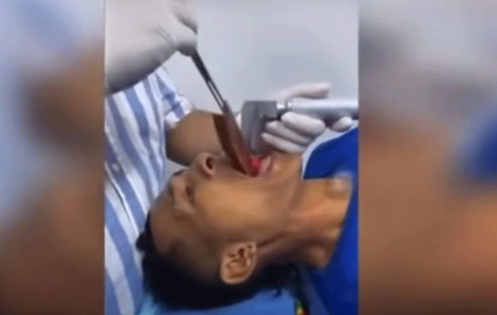 LEKARI NISU MOGLI DA VERUJU ŠTA SU MU IZVUKLI IZ GRLA, morali da snime ovaj bizarni detalj (VIDEO)
