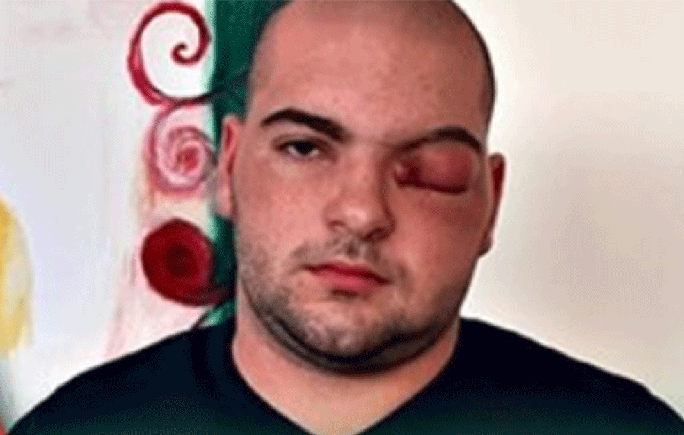 TUŽNA VEST: Preminuo Matija Božić, momak za čije je izlečenje Srbija slala <span style='color:red;'><b>SMS poruke</b></span> (FOTO)