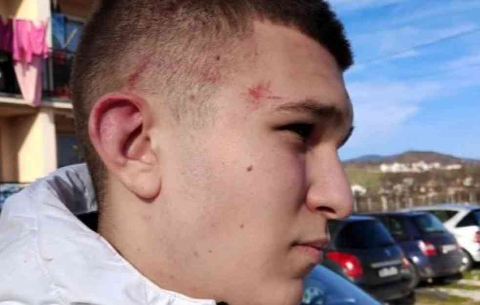 TEŽAK BEZOBRAZLUK PRIŠTINE: Tzv. kosovska policija u izveštaju ne pominje da je pretučeni maloletnik (15) Srbin ni da su napadači Albanci!