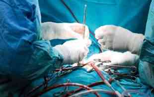 Opšta anestezija – šta se dešava u mozgu dok smo na operacionom stolu