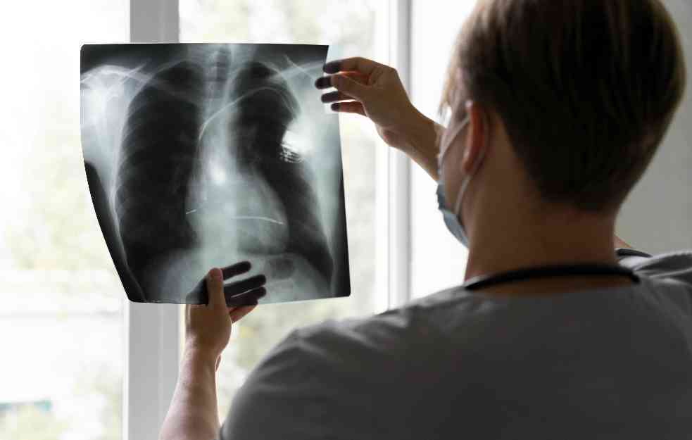 Srbija na drugom mestu u Evropi po smrtnosti od raka pluća: Čak 90 odsto obolelih su pušači