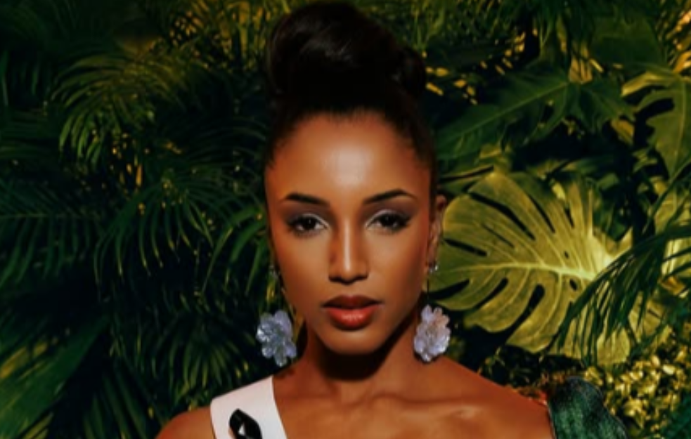 MIS JAMAJKE U BOLNICI NAKON ŠTO JE PALA SA BINE: Ne oporavlja se tako dobro kako smo se nadali