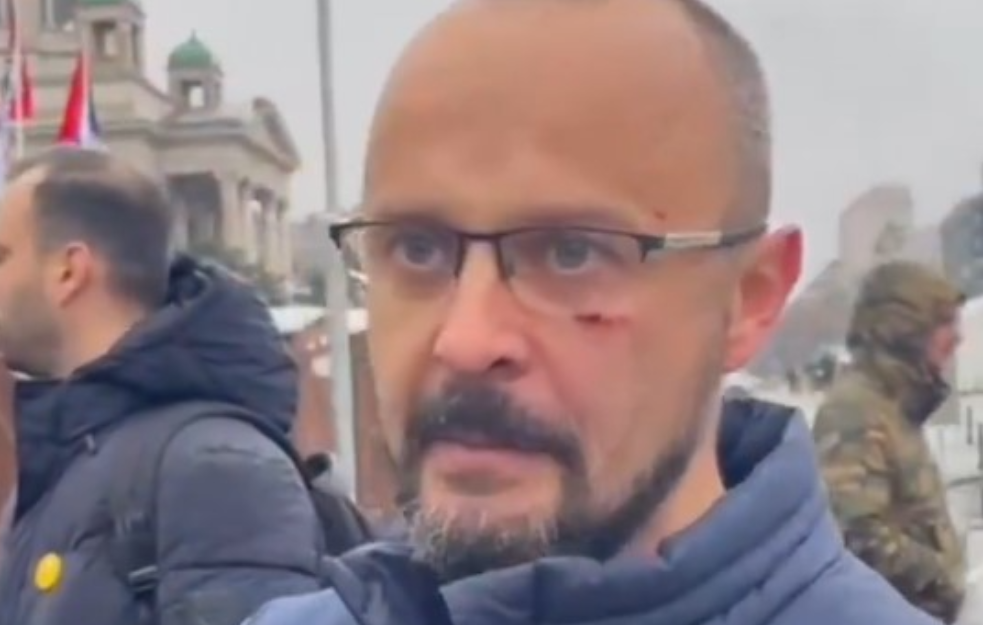 Odbornik Kreni-promeni pretučen dok je snimao huligane u Ćacilendu (VIDEO)