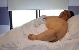 Preminuo najteži čovek na svetu, u jednom trenutku imao 590 kilograma